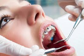 specialist dentist glasgow city centre 